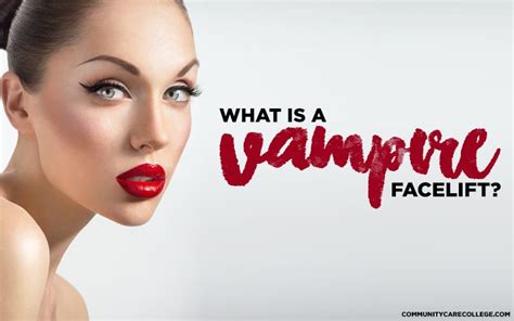 What Is A Vampire Facelift Community Care College