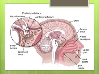 Sellar Suprasellar Tumors Ppt