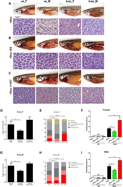 Sex Hormone Treatments Affected Cell Proliferation During Liver Tumor Download Scientific