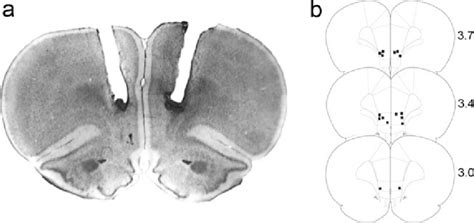 Histological Analysis Of Intra Ifl Cannulae Placements A