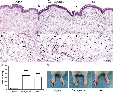 Aal Attenuates The Histopathological Profile Of Carrageenan Induced Paw