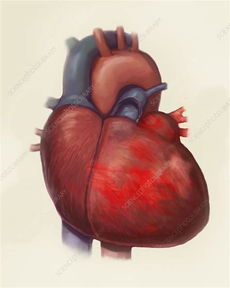 heart failure illustration stock image  science photo