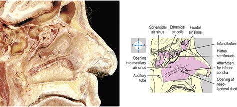 Anatomy Nose Nasal Cavity