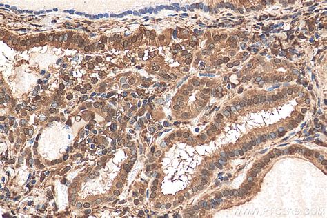 Galectin Antibody Pbs Proteintech