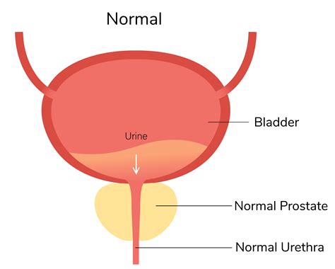 Does Enlarged Prostate Cause Sexual Dysfunction Sale Lasebfaeufmgbr