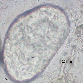 (PDF) Isolation and Identification of Intestinal parasites and protozoa from Flesh flies ...