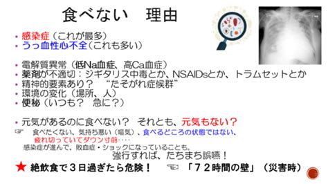 急に食欲が落ちた原因は？ 湯河原の内科「社会福祉法人湯河原福祉会 浜辺の診療所」