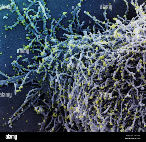 Colorized Scanning Electron Micrograph Of A Cell Infected With A