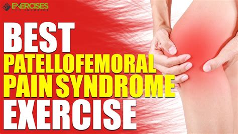 Best Exercise For Patella Femoral Syndrome Online Degrees