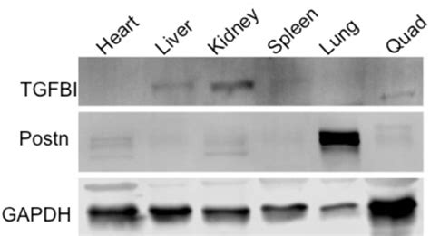 Figure 27 From Dissecting The Roles Of Periostin And TGFBI In