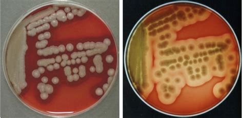 Lecture Gram Rods Bacillus Clostridium Listeria