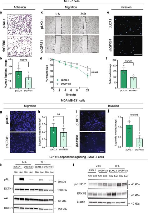 Gpr Stimulates Breast Cancer Cell Adhesion Migration Invasion And