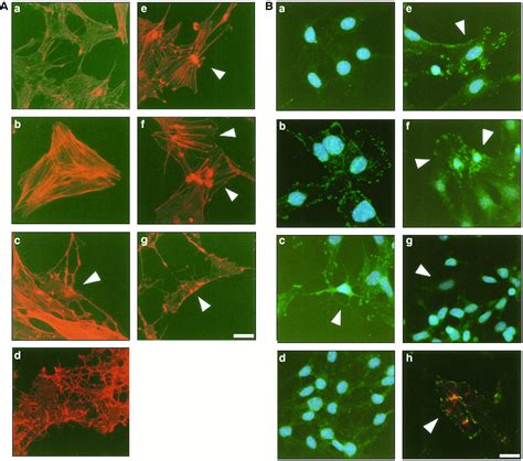 Formation Of Actin Stress Fibers And Focal Adhesions Enhanced By Rho