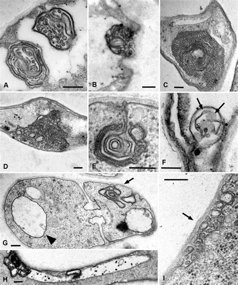 Transmission Electron Microscopic Images Of Various Types Of Lomasomes