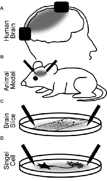 Frontiers Non Invasive Brain Stimulation A Paradigm Shift In