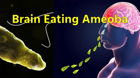 Brain Eating Amoeba नल के पानी में फैल गया दिमाग खाने वाला अमीबा