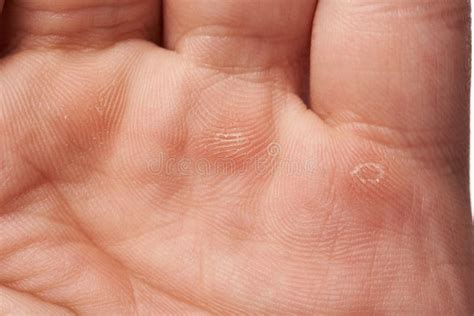 Close Up Of Blister Pack On Table Stock Image Image Of Pink Pill