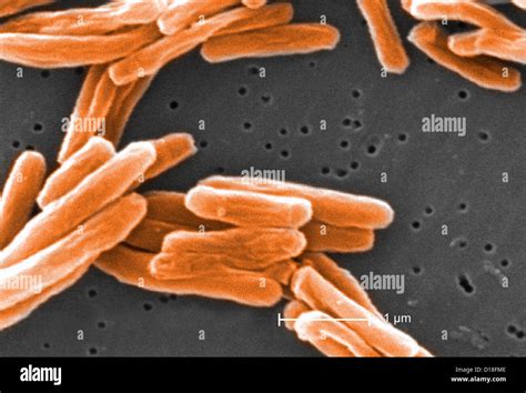 Mycobacterium Tuberculosis Electron Micrograph