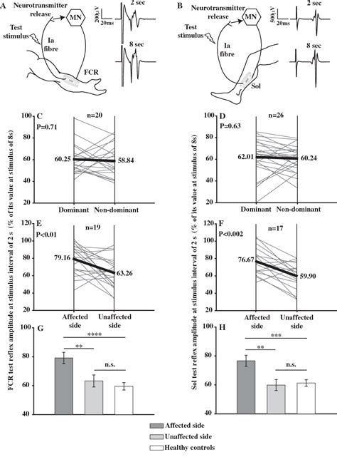 Figure 2 From Impaired Efficacy Of Spinal Presynaptic Mechanisms In