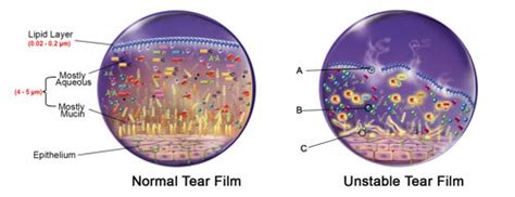 Not All Eye Drops Are Created Equal Nzoptics