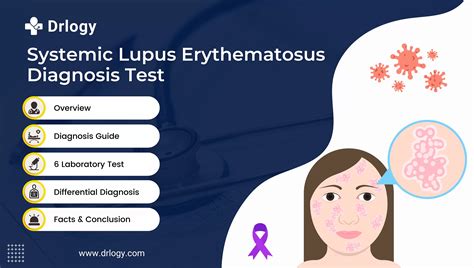 6 Essential SLE Diagnosis Tests for Accurate Assessment - Drlogy