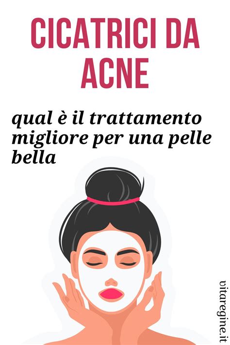 Cicatrici da acne qual è il trattamento migliore per una pelle bella