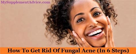 How To Get Rid Of Fungal Acne In 6 Steps Supplementox