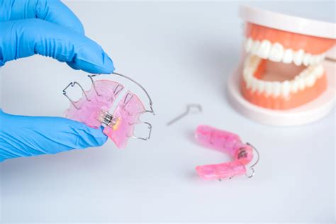 How Retainers Keep Your Smile Aligned Citrus Grove Orthodontics