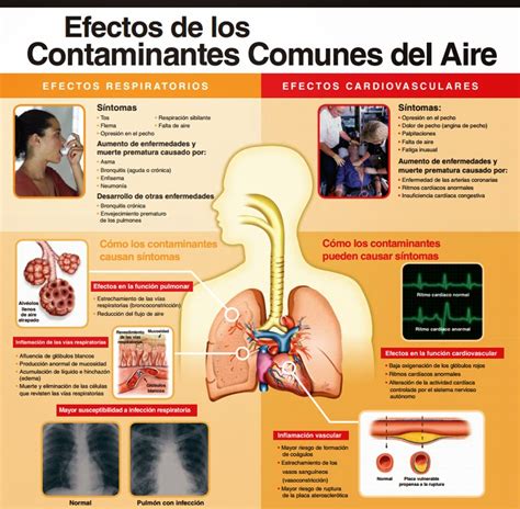 La Contaminación Del Aire Efectos De La Contaminación Del Aire En La Salud