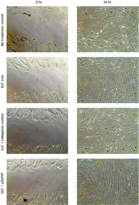 Figure From Rnai Based Gene Therapy Targeting Zgpat Promotes Egf