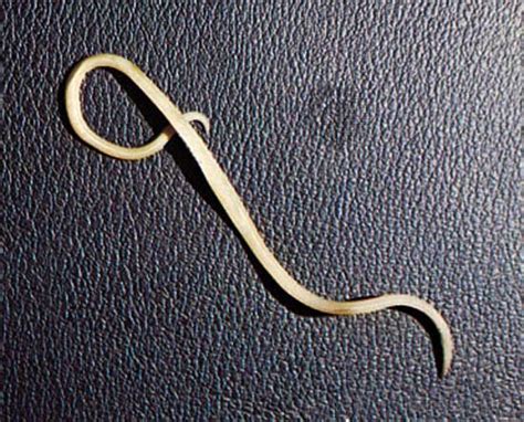 Roundworm Nematode Species Ascaris Lumbricoides Britannica