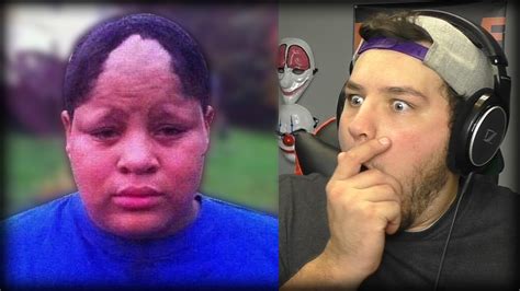 Funny Hairlines : Funny Hairline Fails (10 MINUTE EDITION) || Reaction - YouTube / Compilation ...