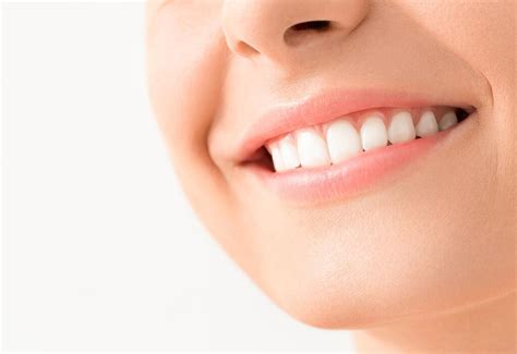 Coral Gables Fl Teeth Bonding Gables Ismile Dental Spa