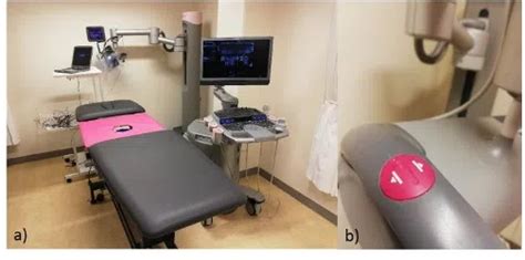 Fig 1 Automated Breast Ultrasound Scanning And Biopsy System A And Button To Initiate The