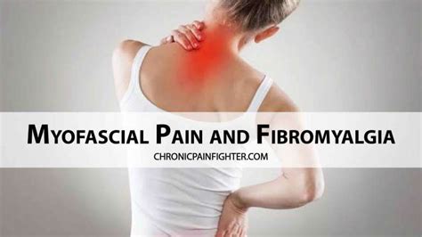 Myofascial Pain And Fibromyalgia