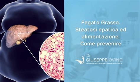 Steatosi Epatica Alimentazione Come Prevenire Il Fegato Grasso