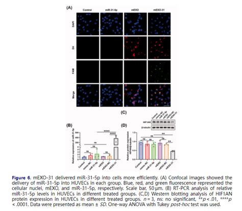 Milk Exosomes Mediated Mir P Delivery Accelerates Diabetic Wound