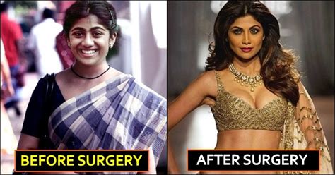 Bollywood Actresses Who Underwent Breast Implant Surgery The Youth