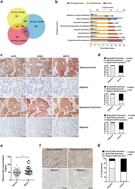 Transcriptome Sequencing Of Nsclc Tissues The Expression Of Klf