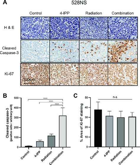 Cleaved Caspase 3 And Ki 67 Immunohistochemical Stain On Ex Vivo Tissue