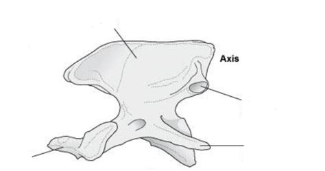 Axis Bone Diagram Quizlet