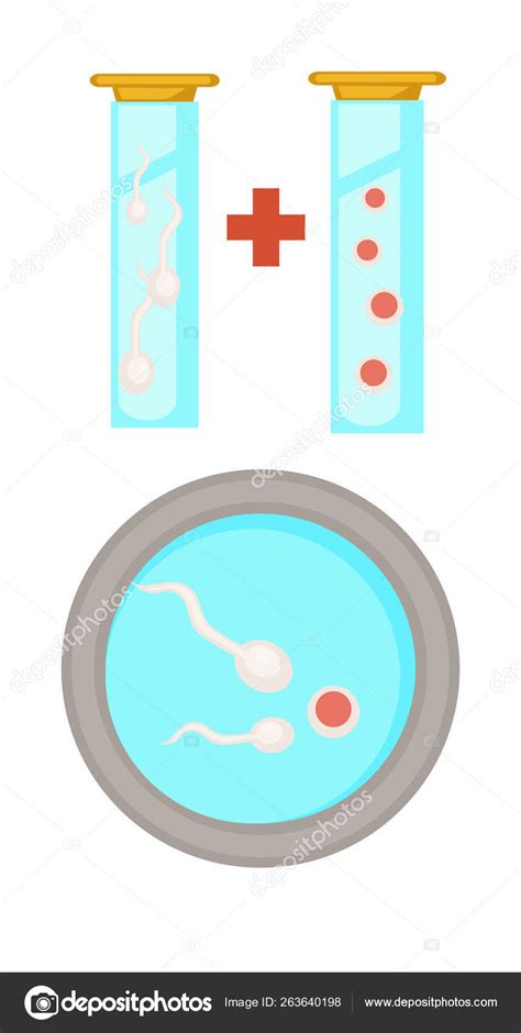 Pregnancy Medicine Vitro Fertilization Stages Egg Retrieval Sperm