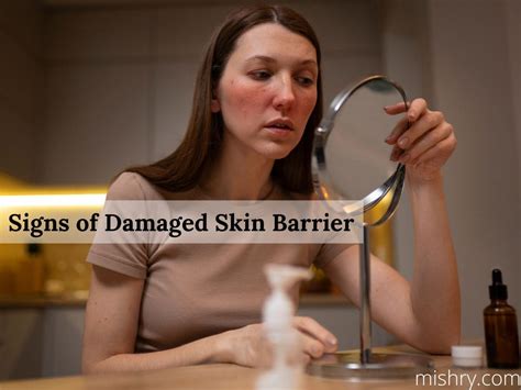 Signs That Your Skin Barrier Is Damaged Ways To Fix It