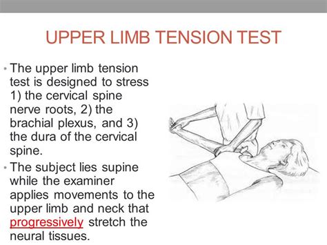 Tests To Assess For Cervical Radiculopathy Perry J Carpenter Dc