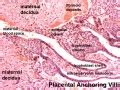 BGDA Practical Placenta Villi Development Embryology