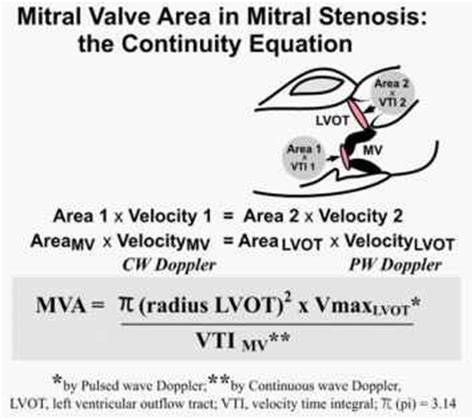 Mitral Valve Stenosis Area Lvot Echocardiography