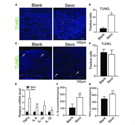 Sevoflurane Led To Developing Neuronal Apoptosis Via Aggravating