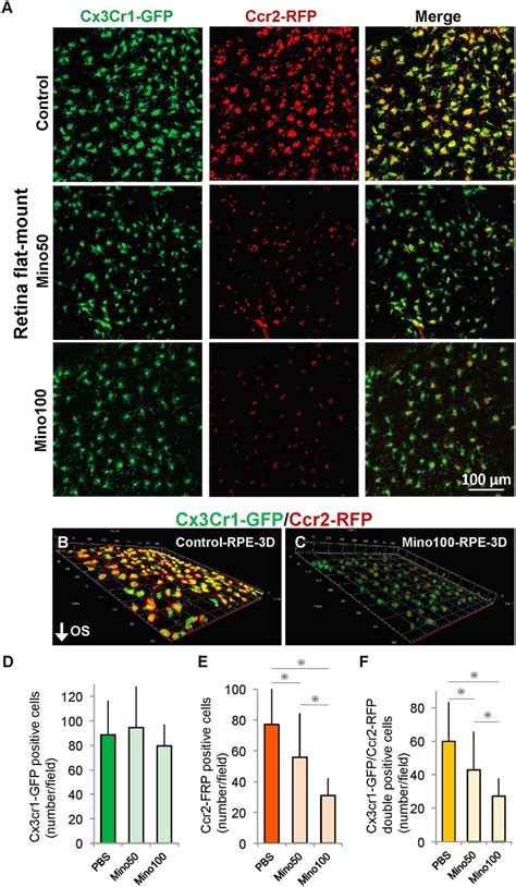 Minocycline Administration Reduced CCR2 Positive Cells In RPE