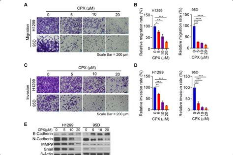 Cpx Suppresses Nsclc Cell Migration And Invasion Via Inhibition Of Emt