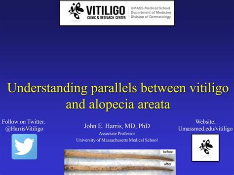 Understanding Parallels between Vitiligo and Alopecia Areata | PPT